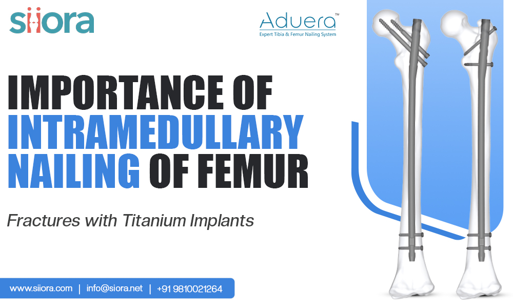 Intramedullary Nailing of Femur Fractures