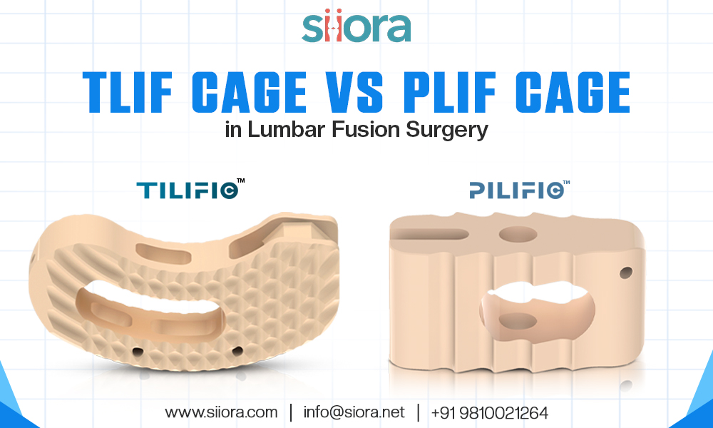 TLIF Cage vs PLIF Cage
